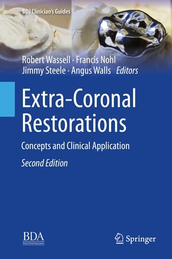 cover of Extra-Coronal Restorations 2nd edition