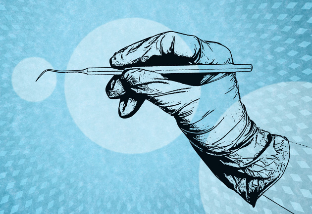 A drawing of a hand with a disposable glove holding a dental probe